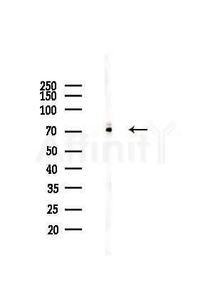 EXOC5 Antibody - Western blot analysis of lysates from Hela cells(starvation,24h treatment), using EXOC5 Antibody at 1/1000 dilution.