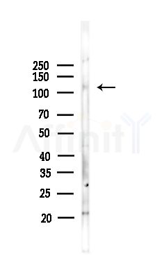 FAM65B Antibody - Western blot analysis of lysates from Hela cells(heat-shock,45min treatment), using FAM65B Antibody at 1/1000 dilution.