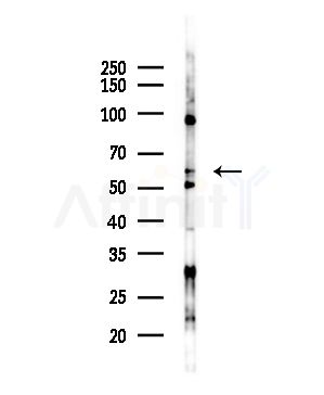 FOXO6 Antibody - Western blot analysis of lysates from COLO205 cells(UV,30min treatment), using FOXO6 Antibody at 1/1000 dilution.