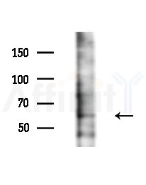 GEFT Antibody - Western blot analysis of extracts from HepG2 cells(starvation,24h treatment), using GEFT Antibody at 1/1000 dilution.