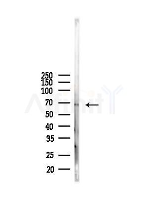 GPD2 Antibody - Western blot analysis of lysates from Mouse kidney, using GPD2 Antibody at 1/1000 dilution.
