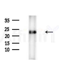 GREM2 Antibody - Western blot analysis of extracts from HepG2 cells(starvation,24h treatment), using GREM2 Antibody at 1/1000 dilution.