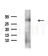 GSTM3 Antibody - Western blot analysis of extracts from B16F10-LUC cells(heat-shock,45min treatment), using GSTM3 Antibody at 1/1000 dilution.