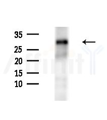 GSTM3 Antibody - Western blot analysis of extracts from HepG2 cells(starvation,24h treatment), using GSTM3 Antibody at 1/1000 dilution.