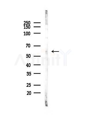 HPSE Antibody - Western blot analysis of lysates from COLO205 cells(heat-shock,45min treatment), using HPSE Antibody at 1/1000 dilution.