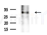 KCTD12 Antibody - Western blot analysis of extracts from HepG2 cells(starvation treatment), using KCTD12 Antibody at 1/1000 dilution.