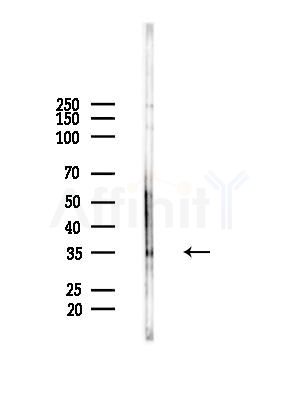 KCTD12 Antibody - Western blot analysis of lysates from HepG2 cells(starvation treatment), using KCTD12 Antibody at 1/1000 dilution.