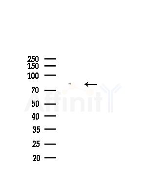 LETM1 Antibody - Western blot analysis of lysates from Hela cells(starvation,24h treatment), using LETM1 Antibody at 1/1000 dilution.