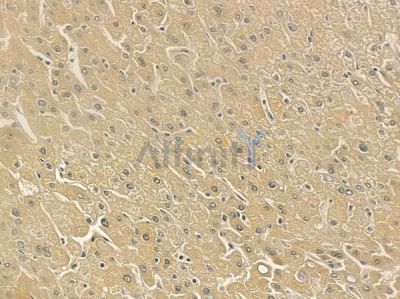 EIF2D Antibody - DF12419 at 1/100 staining human normal liver tissue by IHC-P.