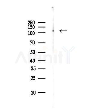 LIV-1/ZIP6 Antibody - Western blot analysis of lysates from Rat brain, using LIV-1/ZIP6 Antibody at 1/1000 dilution.