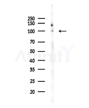 LIV-1/ZIP6 Antibody - Western blot analysis of lysates from HepG2 cells, using LIV-1/ZIP6 Antibody at 1/1000 dilution.