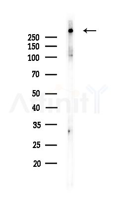 MAP1B Antibody - Western blot analysis of lysates from COLO205 cells(UV,30min treatment), using MAP1B Antibody at 1/1000 dilution.