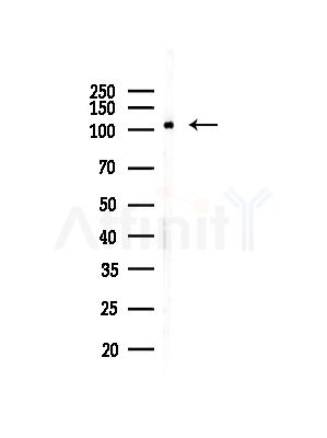 MTHFD1L Antibody - Western blot analysis of lysates from Rat testis, using MTHFD1L Antibody at 1/1000 dilution.