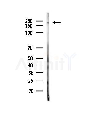 MYH6 Antibody - Western blot analysis of lysates from Rat lung, using MYH6 Antibody at 1/1000 dilution.