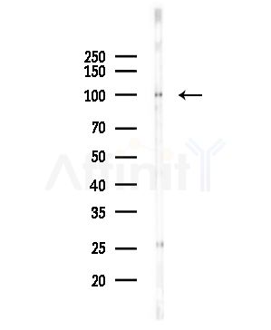 NAT10 Antibody - Western blot analysis of lysates from COLO205 cells(UV,30min treatment), using NAT10 Antibody at 1/1000 dilution.