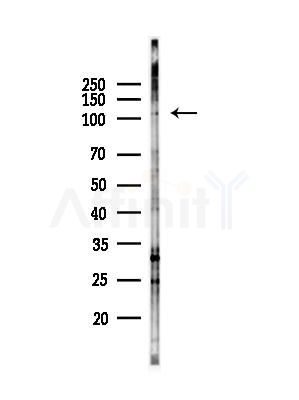 NCKAP1 Antibody - Western blot analysis of lysates from EC304 cells(heat-shock,45min treatment), using NCKAP1 Antibody at 1/1000 dilution.
