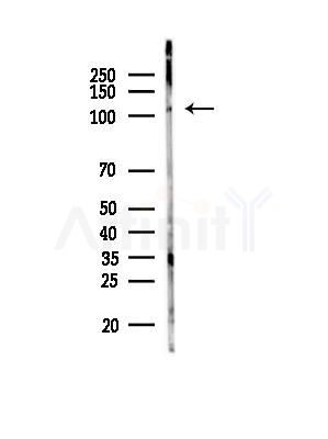 NCKAP1 Antibody - Western blot analysis of lysates from PC12 cells(LPS, 4h treatment), using NCKAP1 Antibody at 1/1000 dilution.