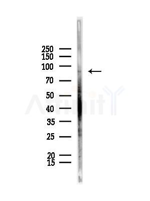 Oligophrenin 1 Antibody - Western blot analysis of lysates from Rat liver, using Oligophrenin 1 Antibody at 1/1000 dilution.