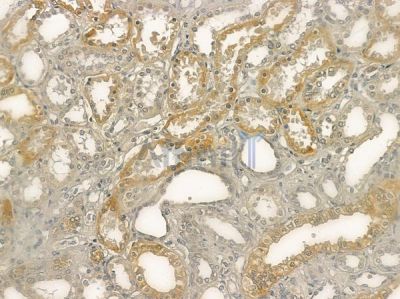 PACS2 Antibody - DF12441 at 1/100 staining human normal kidney tissue by IHC-P.