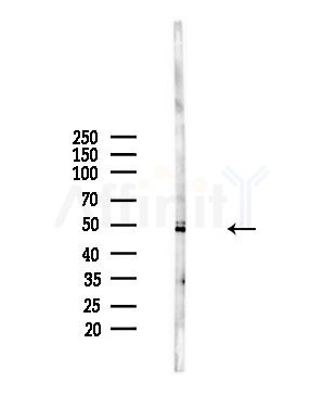 PAFAH2 Antibody - Western blot analysis of lysates from A375 cells(starvation,24h treatment), using PAFAH2 Antibody at 1/1000 dilution.
