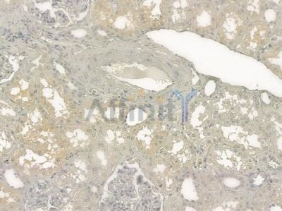 PAFAH2 Antibody - DF12442 at 1/100 staining human normal kidney tissue by IHC-P.