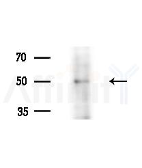 PARVB Antibody - Western blot analysis of extracts from Hela cells(heat-shock,45min treatment), using PARVB Antibody at 1/1000 dilution.
