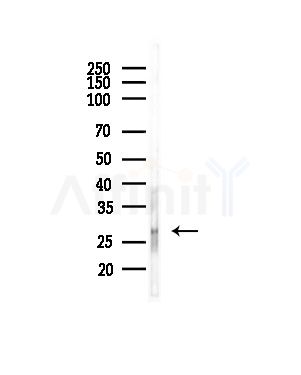 PCMT1 Antibody - Western blot analysis of lysates from COLO205 cells(heat-shock,45min treatment), using PCMT1 Antibody at 1/1000 dilution.