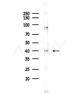 PHF11 Antibody - Western blot analysis of lysates from COLO205 cells(UV,30min treatment), using PHF11 Antibody at 1/1000 dilution.
