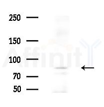 PHF17 Antibody - Western blot analysis of extracts from Hela cells(heat-shock,45min treatment), using PHF17 Antibody at 1/1000 dilution.