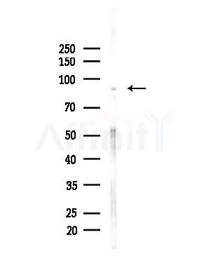 PHF17 Antibody - Western blot analysis of lysates from Hela cells(heat-shock,45min treatment), using PHF17 Antibody at 1/1000 dilution.
