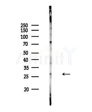 RAB12 Antibody - Western blot analysis of lysates from Rat brain, using RAB12 Antibody at 1/1000 dilution.
