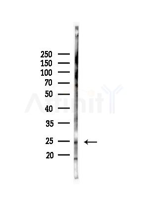 RAB14 Antibody - Western blot analysis of lysates from COLO205 cells(UV,30min treatment), using RAB14 Antibody at 1/1000 dilution.