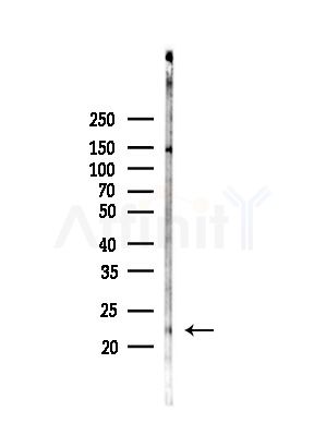 RBBP9 Antibody - Western blot analysis of lysates from COLO205 cells(UV,30min treatment), using RBBP9 Antibody at 1/1000 dilution.