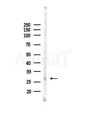 REEP2 Antibody - Western blot analysis of lysates from COLO205 cells(UV,30min treatment), using REEP2 Antibody at 1/1000 dilution.
