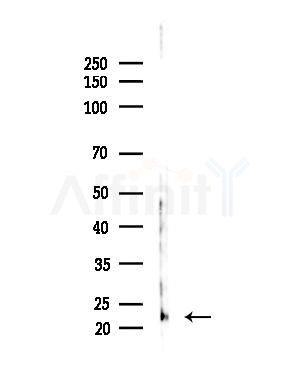 REEP6 Antibody - Western blot analysis of lysates from Hela cells(heat-shock,45min treatment), using REEP6 Antibody at 1/1000 dilution.