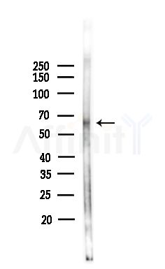 RIC8B Antibody - Western blot analysis of lysates from Hela cells(heat-shock,45min treatment), using RIC8B Antibody at 1/1000 dilution.