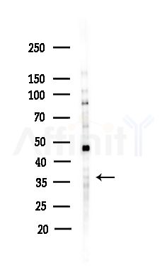 RLBP1 Antibody - Western blot analysis of lysates from COLO205 cells(heat-shock,45min treatment), using RLBP1 Antibody at 1/1000 dilution.