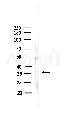 RLBP1 Antibody - Western blot analysis of lysates from Hela cells(heat-shock,45min treatment), using RLBP1 Antibody at 1/1000 dilution.
