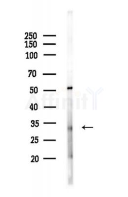 ROGDI Antibody - Western blot analysis of lysates from LoVo cells(heat-shock,45min treatment), using ROGDI Antibody at 1/1000 dilution.