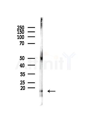 RPS14 Antibody - Western blot analysis of lysates from Rat brain, using RPS14 Antibody at 1/1000 dilution.