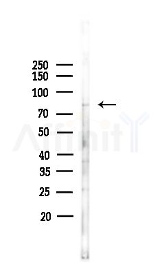 SEC63 Antibody - Western blot analysis of lysates from Hela cells(heat-shock,45min treatment), using SEC63 Antibody at 1/1000 dilution.