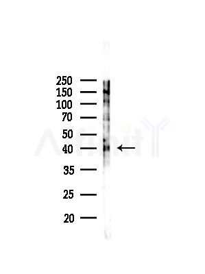 SGCG Antibody - Western blot analysis of lysates from MCF7 cells(heat-shock,45min treatment), using SGCG Antibody at 1/1000 dilution.