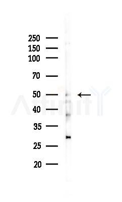 SHMT1 Antibody - Western blot analysis of lysates from MCF7 cells(heat-shock,45min treatment), using SHMT1 Antibody at 1/1000 dilution.