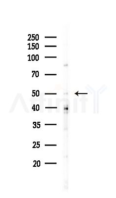 SHMT1 Antibody - Western blot analysis of lysates from COLO205 cells(UV,30min treatment), using SHMT1 Antibody at 1/1000 dilution.