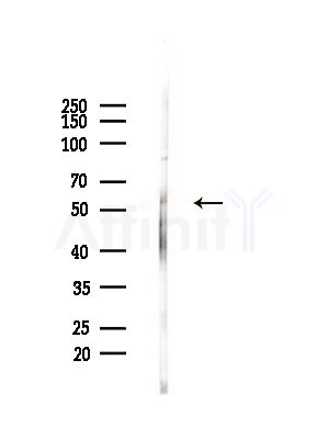 SLC13A2 Antibody - Western blot analysis of lysates from Rat brain, using SLC13A2 Antibody at 1/1000 dilution.