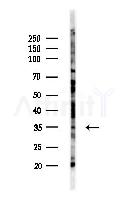 Syntaxin 17 Antibody - Western blot analysis of lysates from MCF7 cells(heat-shock,45min treatment), using Syntaxin 17 Antibody at 1/1000 dilution.