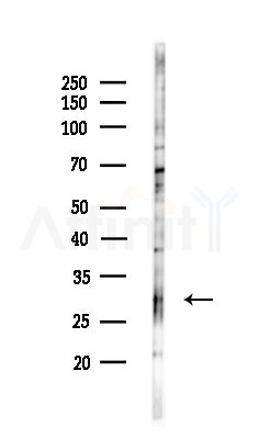 Syntaxin 17 Antibody - Western blot analysis of lysates from COLO205 cells(UV,30min treatment), using Syntaxin 17 Antibody at 1/1000 dilution.