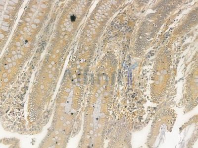 Syntaxin 17 Antibody - DF12483 at 1/100 staining human normal colon tissue by IHC-P.