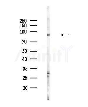 TCTN2 Antibody - Western blot analysis of lysates from HepG2 cells(LPS,4h treatment), using TCTN2 Antibody at 1/1000 dilution.