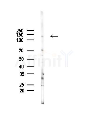 TRAPPC9 Antibody - Western blot analysis of lysates from HepG2 cells(starvation treatment), using TRAPPC9 Antibody at 1/1000 dilution.